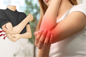 Dirsekte Uyuşma ve Karıncalanmanın Gizli Nedeni: Kubital Tünel Sendromu