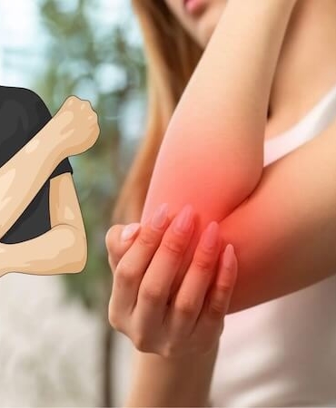 Dirsekte Uyuşma ve Karıncalanmanın Gizli Nedeni: Kubital Tünel Sendromu