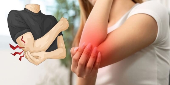 Dirsekte Uyuşma ve Karıncalanmanın Gizli Nedeni: Kubital Tünel Sendromu