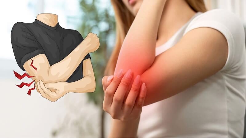 Dirsekte Uyuşma ve Karıncalanmanın Gizli Nedeni: Kubital Tünel Sendromu